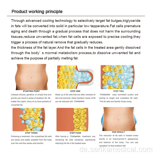 Fettentfernung Kryolipolysis, die Maschine abnimmt